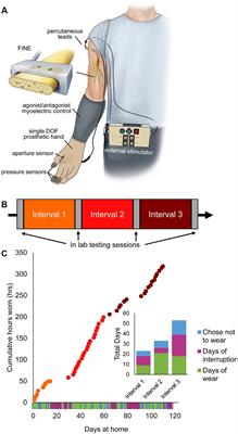 Learning of Artificial Sensation Through Long-Term Home Use of a Sensory-Enabled Prosthesis